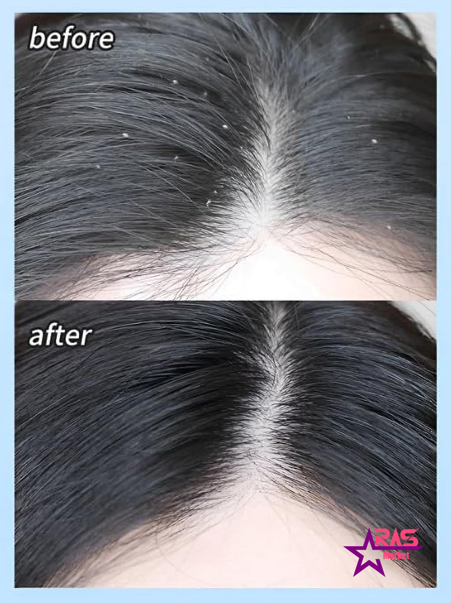 خرید شامپو ضد شوره فاکس حجم 350 میل